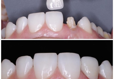 AKSHAR DENTAL CLINIC