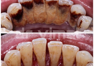 AKSHAR DENTAL CLINIC