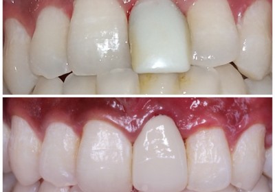 AKSHAR DENTAL CLINIC