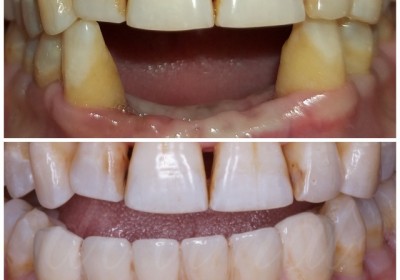 AKSHAR DENTAL CLINIC