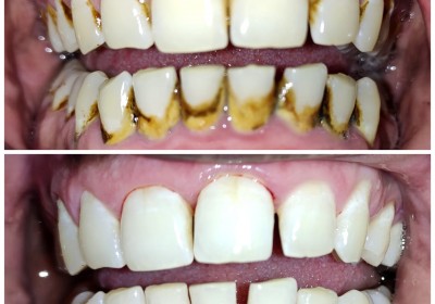 AKSHAR DENTAL CLINIC