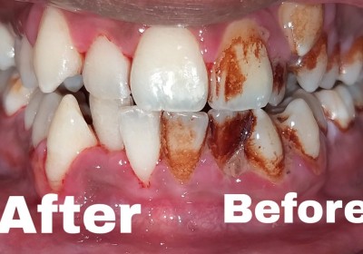 AKSHAR DENTAL CLINIC