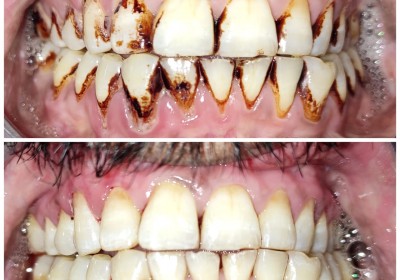 AKSHAR DENTAL CLINIC