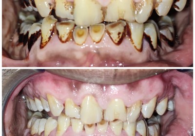 AKSHAR DENTAL CLINIC