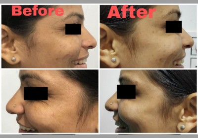 SHILPAN SKIN HAIR AND COSMETIC LASER CENTER