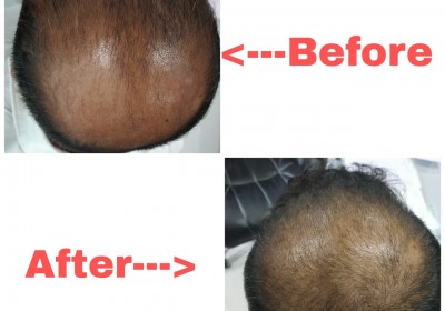 SHILPAN SKIN HAIR AND COSMETIC LASER CENTER