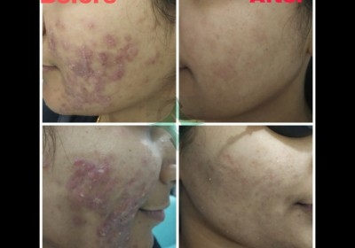 SHILPAN SKIN HAIR AND COSMETIC LASER CENTER