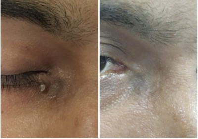 SHILPAN SKIN HAIR AND COSMETIC LASER CENTER
