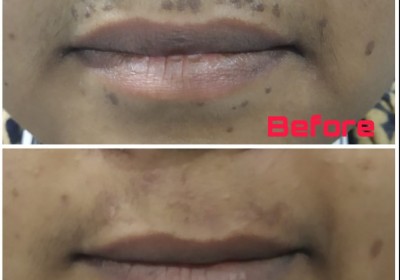 SHILPAN SKIN HAIR AND COSMETIC LASER CENTER